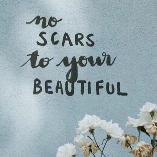Scars To Your Beautiful - Alessia Cara (Acoustic)